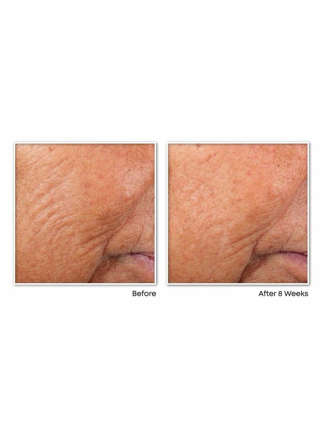 RoC كبسولات مصل الليل لتنعيم الخطوط الدقيقة بالريتينول كوريكشن، علاج يومي للعناية بالبشرة مضاد للشيخوخة، للخطوط الدقيقة، والبقع الداكنة، وندبات حب الشباب، 10 كبسولات - Image 5