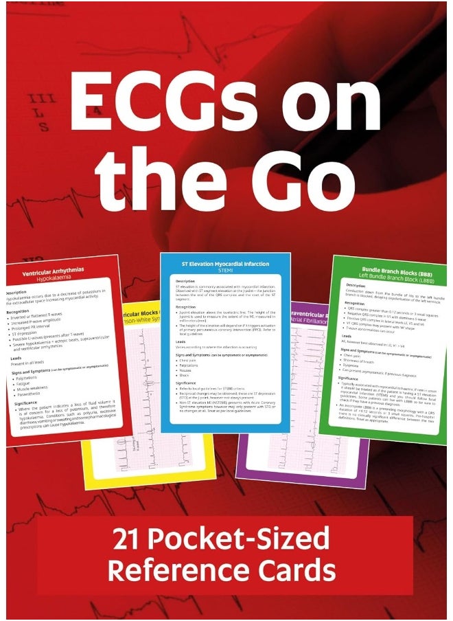 ECGs On The Go 