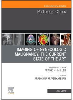Imaging of Gynecologic Malignancy: The Current State of the Art, An Issue of Radiologic Clinics of North America (Volume 61-4) 