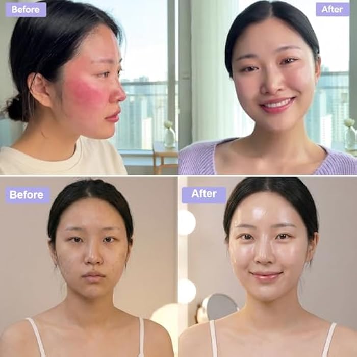 Kewhunt Madecassoside Sheet Mask Blemish Repair, Face Mask korean Skin Care for Sensitive Skin - Hyaluronic Acid, Collagen, Niacinamide, Panthenol, Centella Facial Masks for Sooth, Hydration, Firming 10ea - Image 3