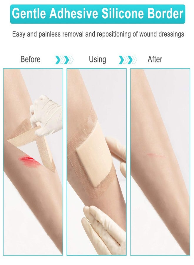 lvonge Silicone Foam Dressing 4"x4"(10 Pack) with Adhesive Border, Wound Care Dressings Highly Absorbent Large Waterproof Silicone Bandages for Pressure Ulcers, Bedsores, Leg Ulcers - Image 4