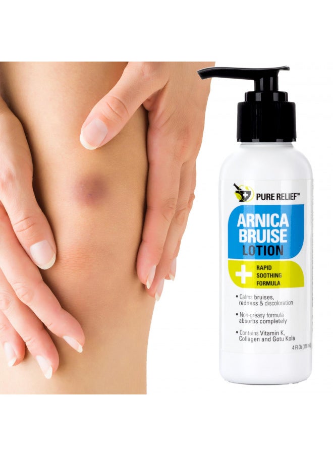 Pure Relief - Pure Relief Arnica Cream Bruise Relief Lotion For Bruising And Swelling On Skin | Bruise Cream Extra Strength Vitamin K Cream | Moisturizing Arnica Bruise Formula Skin Care Gel W/Collagen, 4 Fl Oz - Image 1