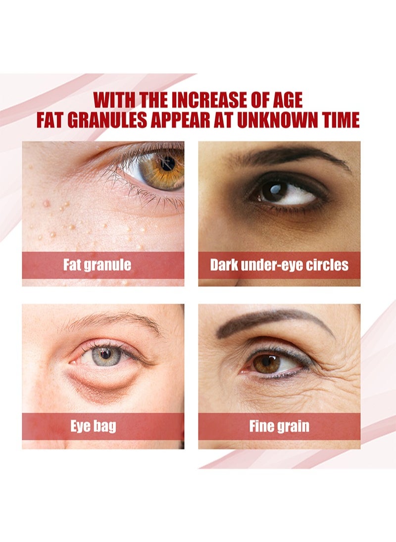 2 Pieces Of Milia Removal Essential, Treats Miliary Spots, Reduces Milia And Sebaceous Glands