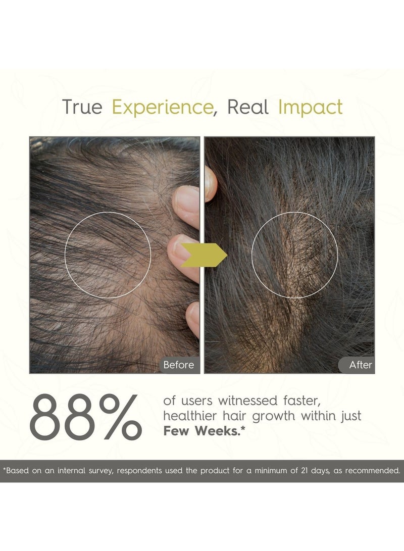 Khadi Traditional Premium Amla Bhringraj Shampoo for Controlling Dandruff & Hairfall, Sulphate and Paraben Free Shampoo, Natural Cleanser for Frizzy Hair - Image 3