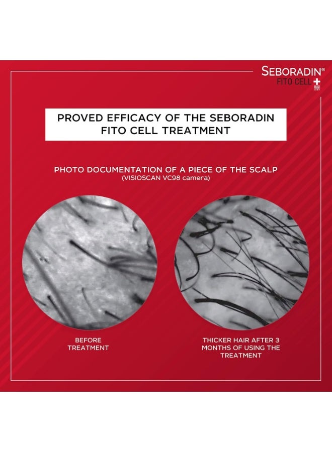Seboradin Hair Loss and regrowth Fitocell Serum Treatment with Swiss Technology Stem Cells Phytocelltec™ Malus Domestica, for Men and Women Stimulates Hair Growth (15 x 6 g) - Image 2