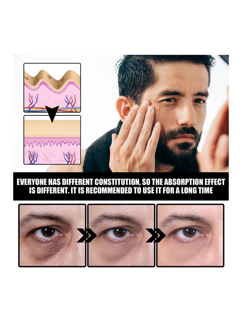 إيلهو Eelhoe تحت كريم العين يقلل من التجاعيد ، يقلل من الهالات السوداء ، تشديد العين و ترطيب  - Image 2