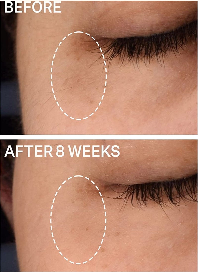 Strivectin - Superc Dark Circle Brightening Eye Serum - Image 1
