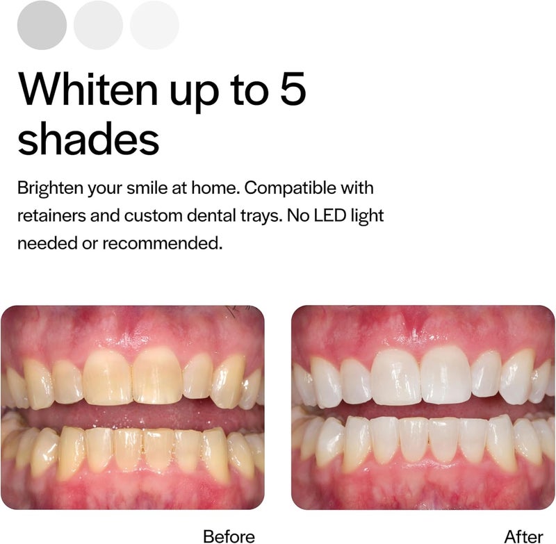 Opalescence Ultradent 5394 10% PF Mint Teeth Whitening Gel - 4 Pack - Image 3