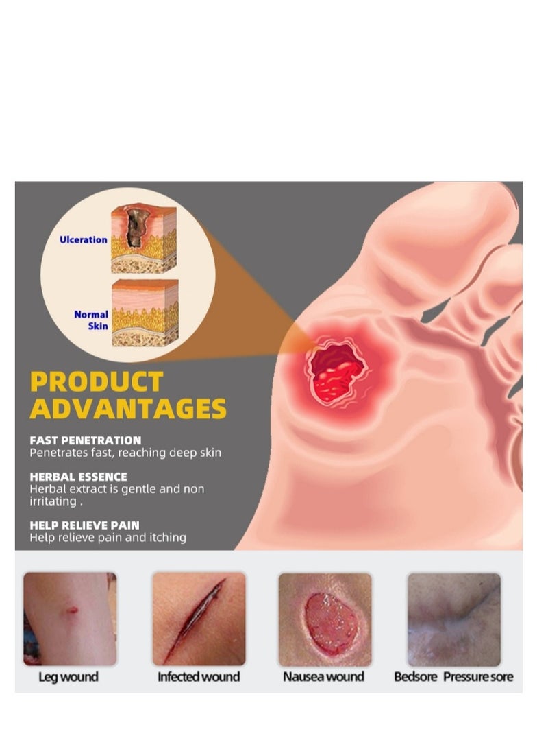 سوميفون كريم قرح الفراش، 20 جرام قطعتان من كريم مرهم قرح الفراش سريع المفعول، كريم قرح الفراش للشفاء - Image 4