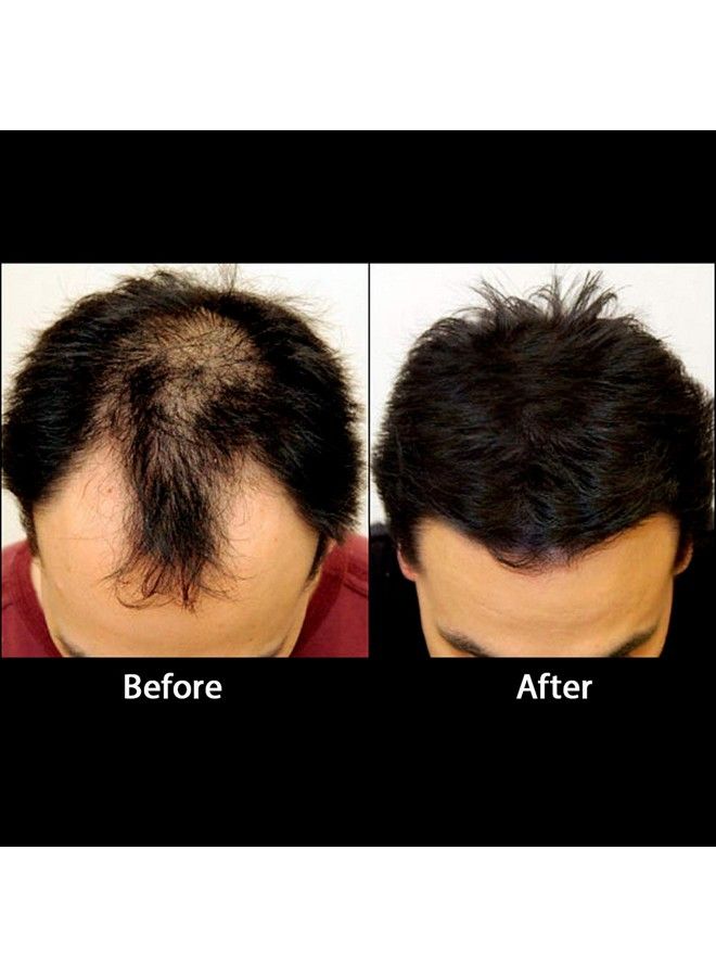 Rebuilds Hair Building Fibers Dark Brown 27 Grams - Image 4