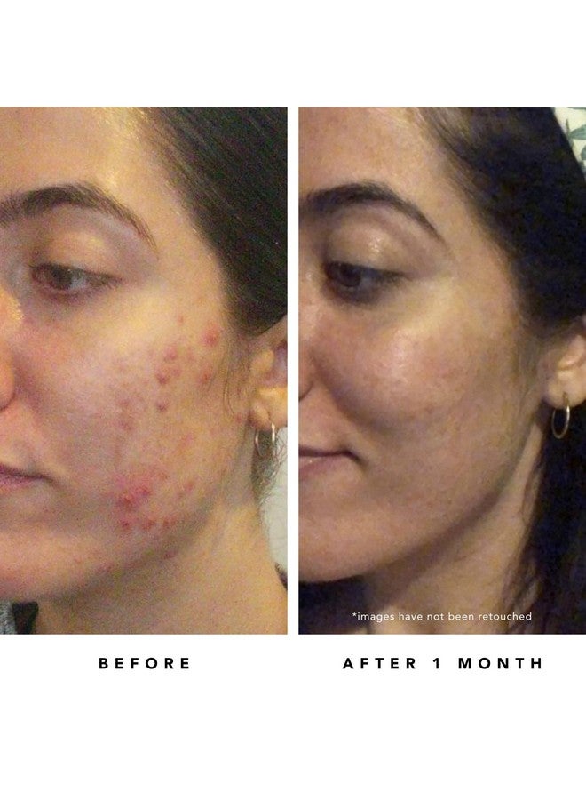 HERBIVORE Blue Tansy Bha & Enzyme Pore Refining Mask Naturally Clarifies Acne Blemishes & Redness Vegan & Crueltyfree 60 Ml / 2.02 Oz - Image 5