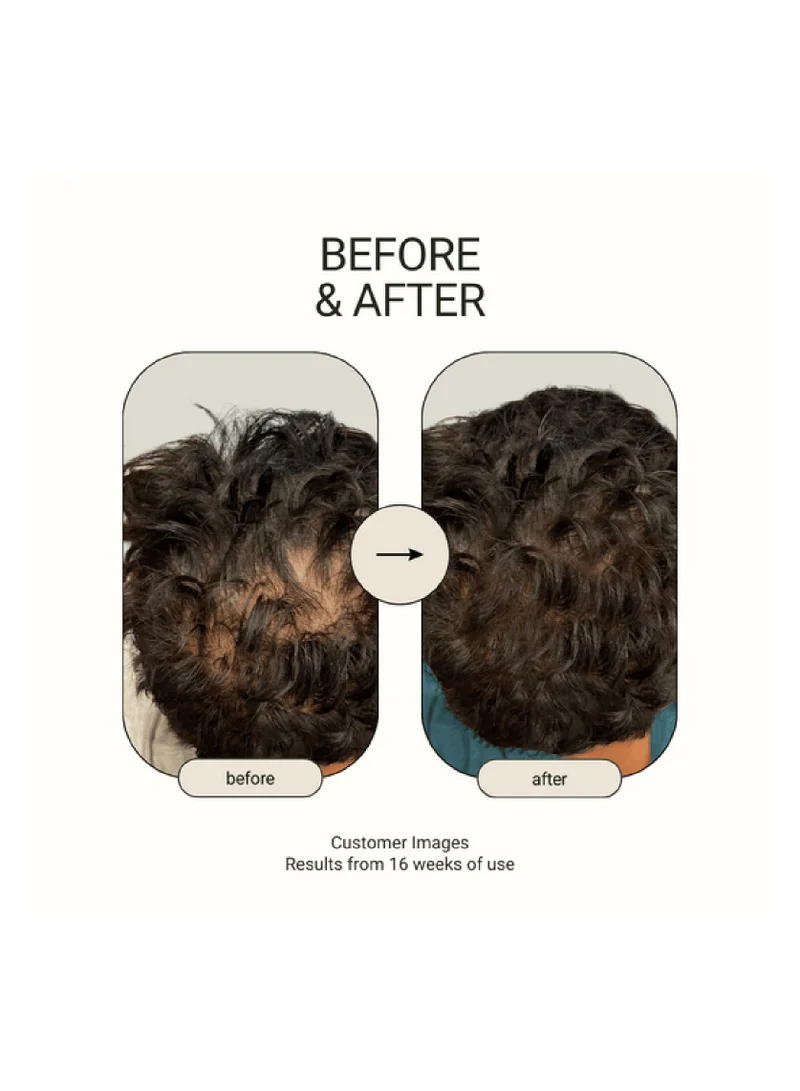Rthvi Revitalize Natural Hair Growth Oil