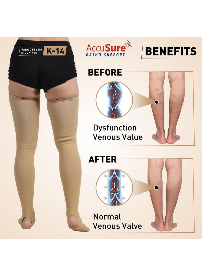AccuSure Varicose Vein Stockings (Anatomical Shape,Easy to use, Non Slippagen, Durable)-Thigh Length for Varicose Veins Can Be Used By Men & Women (XL) - Image 3