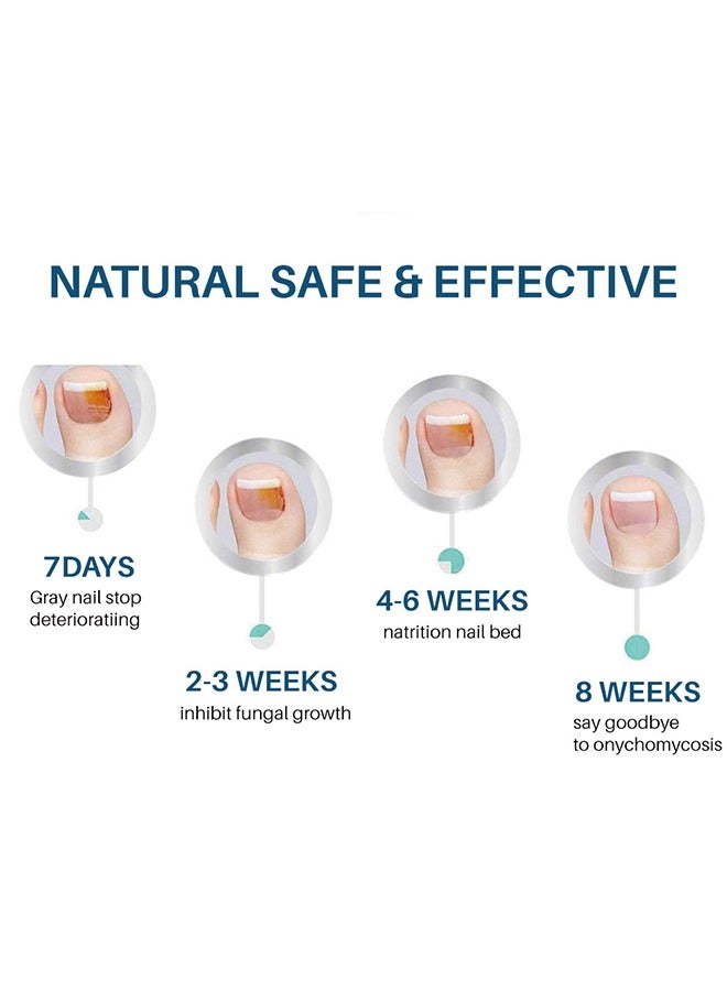 Lanthome Toenail Fungus Treatment Extra Strength: Nail Repair Solution for Toenail or Fingernail - Strong Renewal Liquid for Discolored or Damaged Nail - 10 ML - Image 4