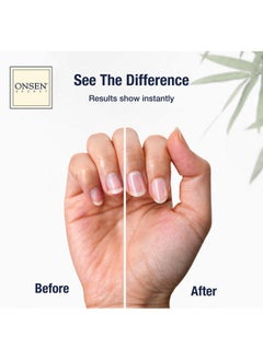 Onsen Secret Onsen Cuticle Cream w/Nail Cuticle Oil | Cuticle Softener with Japanese Natural Healing Minerals | Nail Care Serum to Soothe, Repair & Strengthen Cuticles and Nails | Visible Results (1 Count/15 ml)  - Image 2