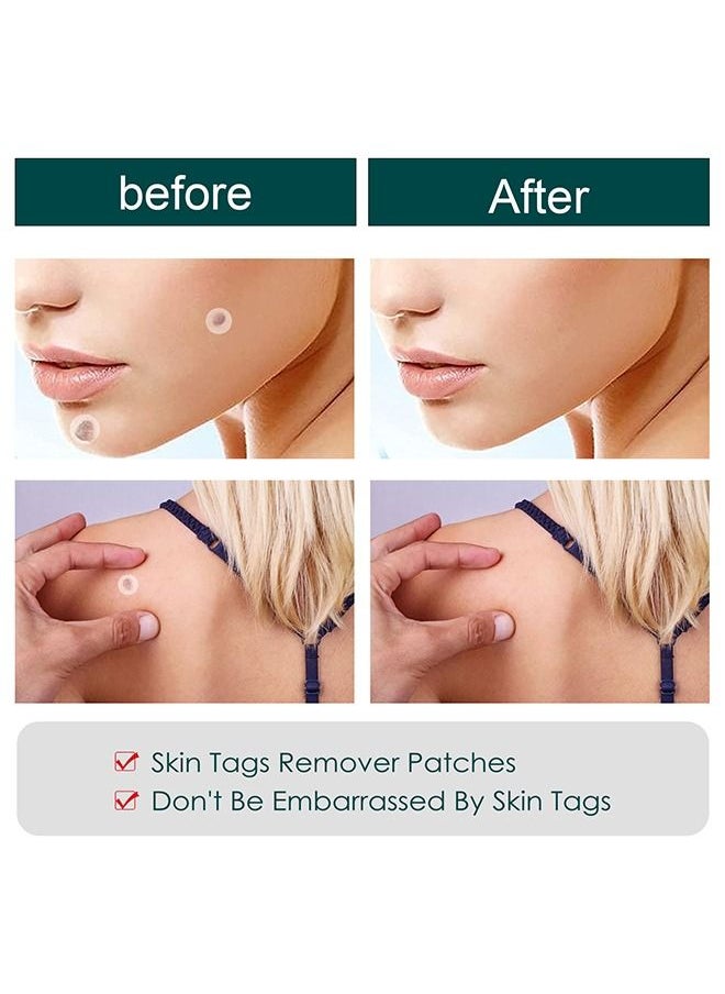 Skin T-ag Remover Patches Mole Wart Removing Sticker Natural Ingredients 120 Pieces