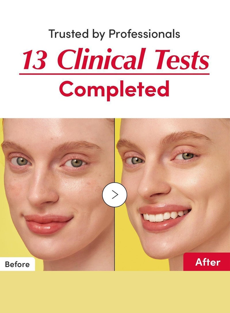 إيكوالبيري سيروم فيتامين لتفتيح البشرة - سيروم فيتامين سي لتفتيح البشرة مع النياسيناميد | يقوي حاجز البشرة | يرطب البشرة باستخدام السيراميد وحمض الهيالورونيك، 30 مل / 1.01 أونصة. - Image 5