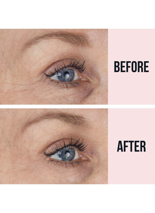 Sio Beauty Eye & Smile Antiwrinkle Patches 2 Week Supply Overnight Smoothing Silicone For Fine Lines & Puffiness  - Image 2