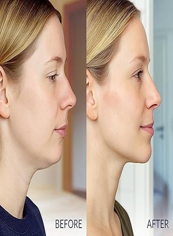 قناع الكولاجين لشدّ الوجه وتحديد خط الفك من أولاملي | حزام مزدوج للذقن للنساء | شريط شد الوجه وتحديد الفك | قناع الكولاجين لشدّ الرقبة | حزام للذقن أثناء النوم | حمض الهيالورونيك، الألوفيرا (عبوة واحدة) - Image 5