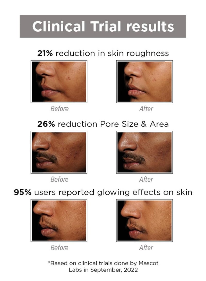 SkinQ Face Brightening Serum with Licorice and Lactic Acid AHA Based Serum for Tan Pigmentation and Dark Spots Exfoliates Brightens and Repairs Sun Damaged Skin for Women and Men 15ml - Image 5