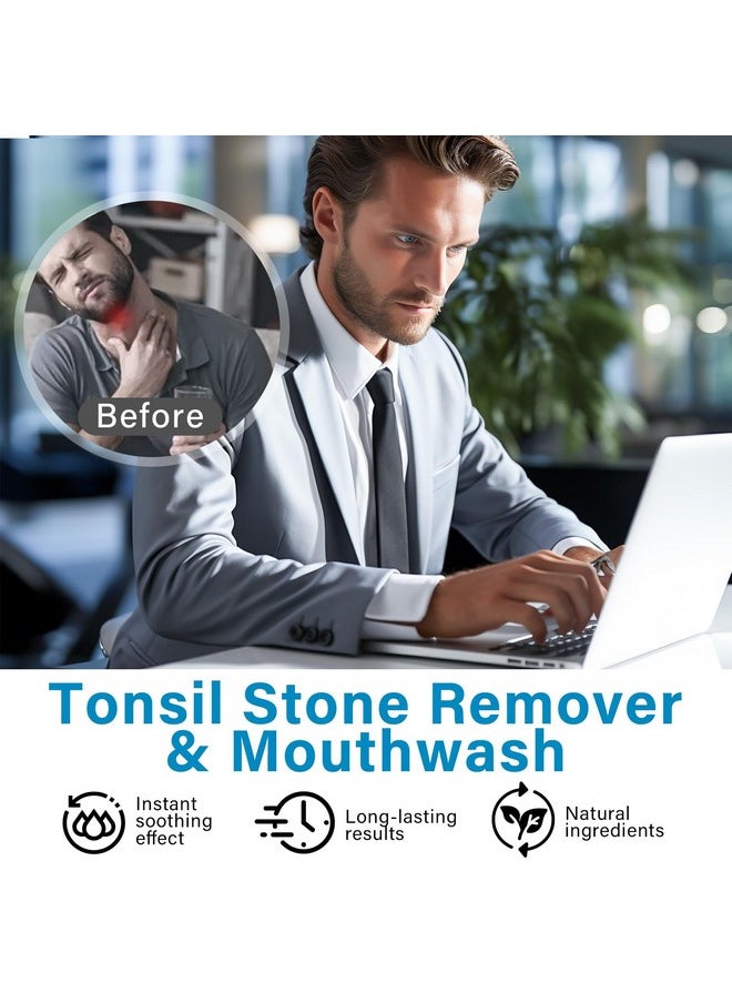 Green Hills - Tonsil Stone Remover, Tonsil Stone Mouthwash - Natural Alcohol Free Oral Rinse Liquid To Help Soothe Tonsils, Eliminate Bad Breath & Ease Dry Mouth - Image 1