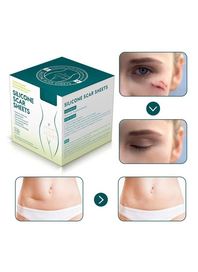 Generic - Silicone Scar Sheets, Professional Tape, Gel for Scars, Strips, Soft Sheets Acne, Keloid, Burns, Acne - Image 1