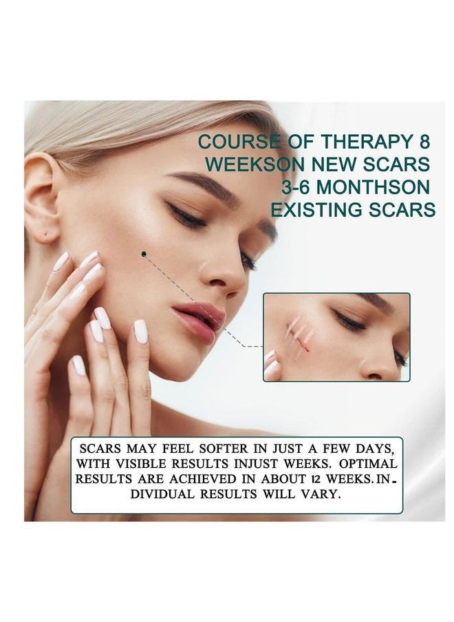 Generic - Silicone Scar Sheets, Professional Tape, Gel for Scars, Strips, Soft Sheets Acne, Keloid, Burns, Acne - Image 1