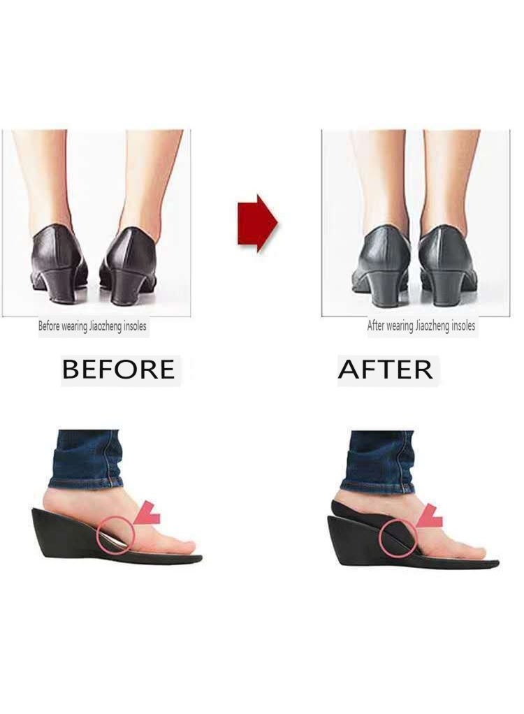 XO leg shape correction insole, inward and outward varus, flat feet, TPR support, anti-collapse correction half-size insole - Image 4