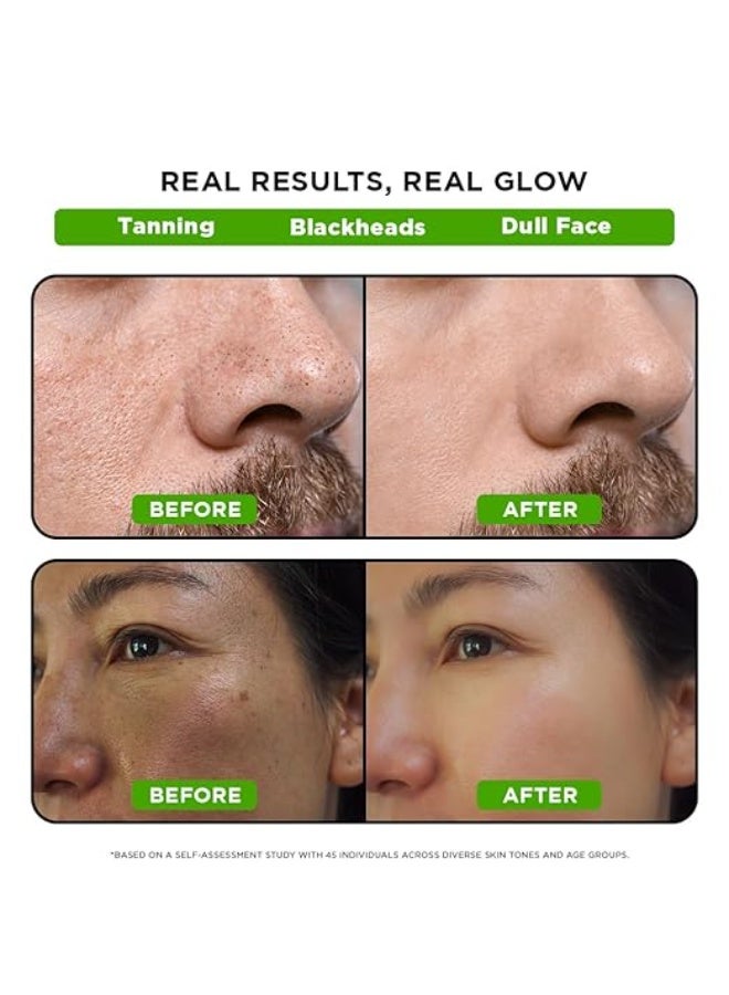 Orgatre Detan Peel Off Face Mask For Glowing Skin | Removes Tan and Minimize Pores | Active Cooling Effect | Enriched with Kojic Acid, Lactic Acid, Glycolic Acid & Bamboo Charcoal (100ml) - Image 3