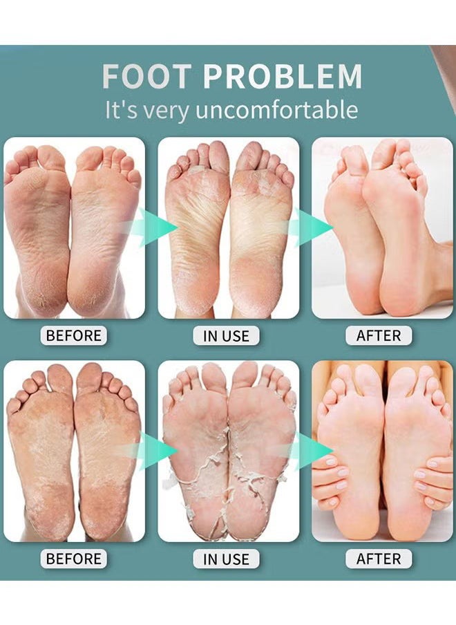 lansiyi - Foot Bacteria Bacteriostasis Spray, Shoe Deodorizer Foot Spray Odor Smell Eliminator Freshener For Athlete Sweat Feet Skin Repair, Natural Ingredients Soothe And Feet Itchy Care Spray - Image 1