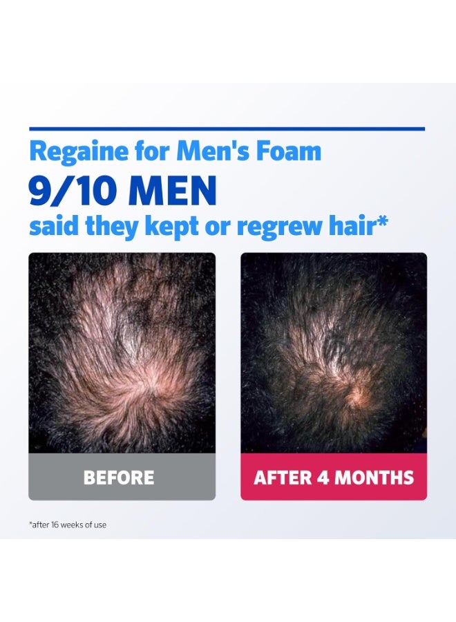 Regaine Minoxidil for Men 5% Foam 73 ml - Image 2