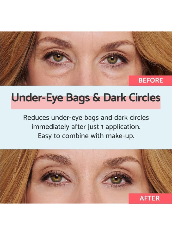 Remescar Eye Bags and Dark Circles Immediate Results 8ml - Image 3