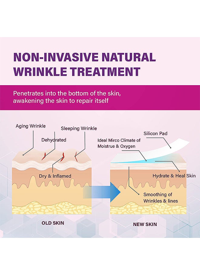 Face Smoothing Patch 160PCS, Forehead Winkle patches, Face Smoothing Patch, Face Lift Tape Invisible, Wrinkle Patches For Face Overnight, Facial Patches To Reduce Fine Wrinkles, Frown And Smile Lines