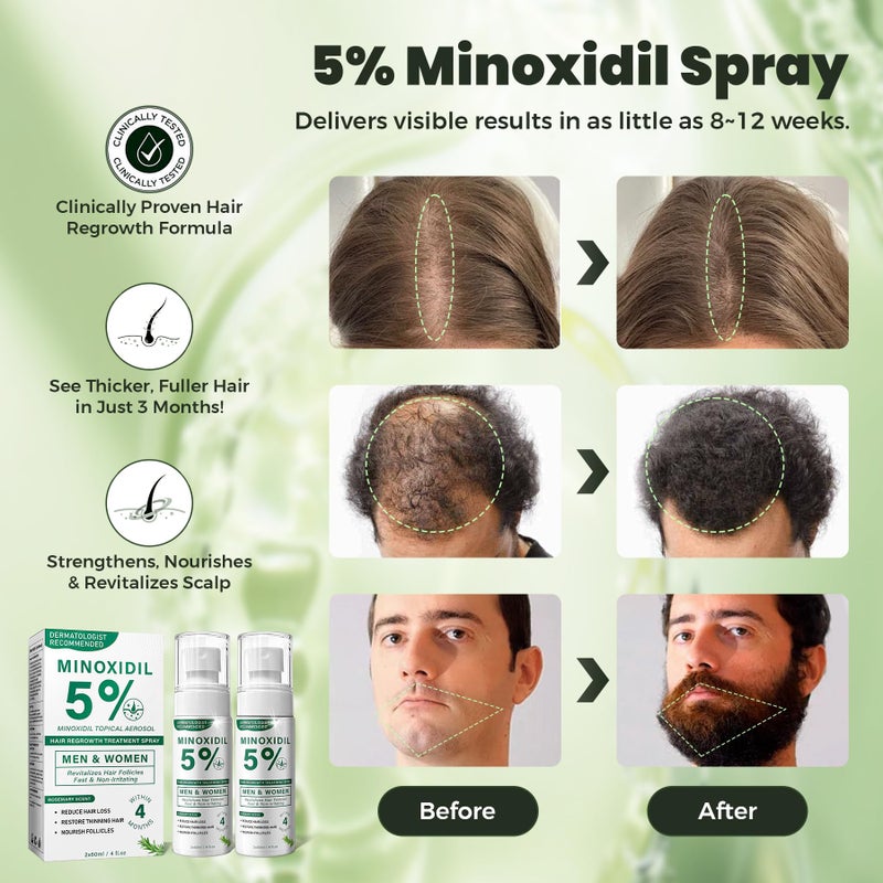 SHIUMORE 5% Minoxidil Hair Regrowth Spray for Men and Women with Rosemary Scent â€“ 2 x 60ml Value Pack for 4+ Months â€“ Lightweight Non Greasy Mist for Thinning Hair Receding Hairline Crown Support (Rosemary) - Image 3