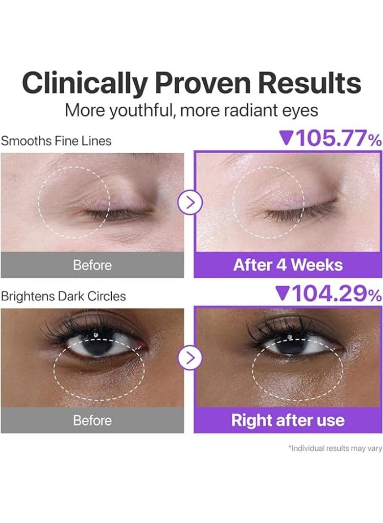 نامبوزين كريم العين نامبوزين رقم 9 بنظام NAD+ والريتينول لشد البشرة وتفتيحها وتنعيم الخطوط - Image 4