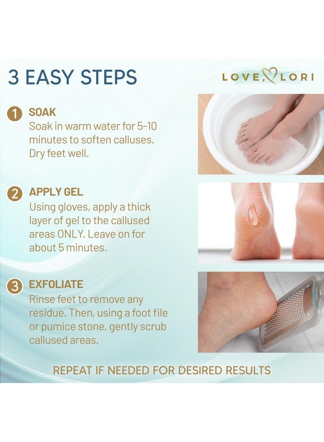 Love, Lori Professional Foot Scrubber Dead Skin Remover Kit - Foot File & Callus Gel Feet Scrubber Scraper Bundle, 6oz - Image 4