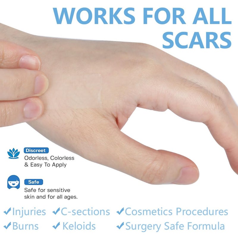 LINXIU Silicone Scar Sheets 16 x 120 Silicone Scar Tape Roll Removal Scar Patches for Surgical Scars Keloid Clear - Image 4