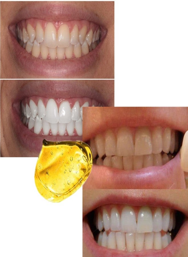 سو سمايل جل تبييض الأسنان Sowsmile 24K Gold Professional Dental Dental Bright White لإزالة البقع الصفراء - Image 3