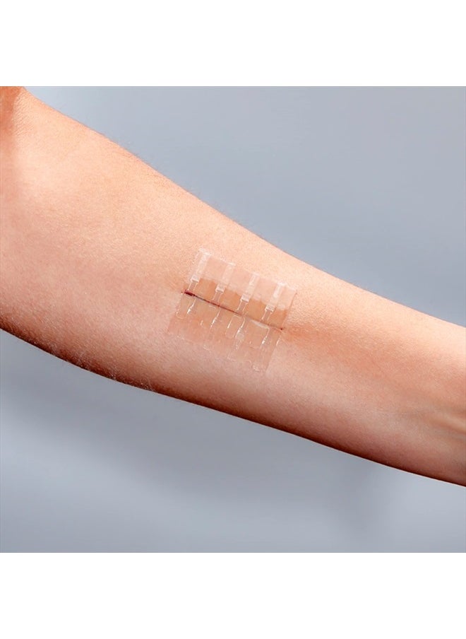 Clozex - Complete Emergency Laceration Kit - Repair Wounds Without Stitches. FDA Cleared Skin Clean Cover Closure Device for 2 Individual Or Combine for 2 1/2 in. Length - Image 1