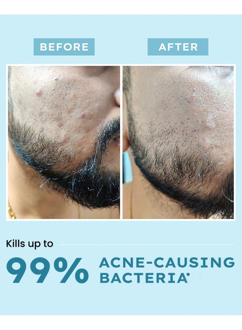 HYPHEN Clarifying Acne Face Wash  | Cleanser For Acne Prone Skin with Salicylic Acid 2%, Zinc PCA, Witch Hazel 10% | Anti-Acne Face Wash for Oil Control, Pore Cleasning | Antibacterial & Non-Drying Formula - 100ml - Image 2