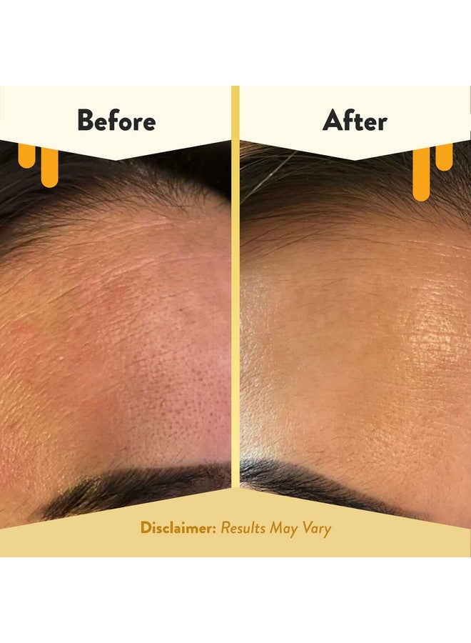 ECZEMA HONEY Czema Honey Nourishing Face Serum Daily Hydrating Serum Face Oil For Eczema Dry & Sensitive Skin (1 Oz) - Image 5