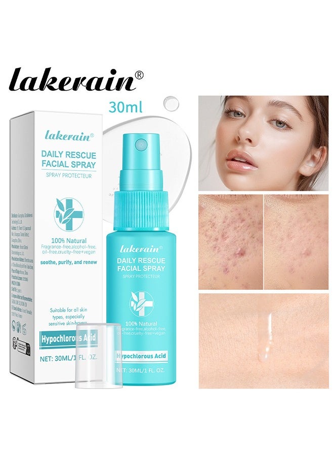 lakerain Daily Rescur Facial Spray - Hypochlorous Acid Face and Skin Spray,Facial Toner with Pure Hypochlorous,Face and Skin Renew Toner Spray,Moisturising Spray for Sensitive Skin 30ML  - Image 1