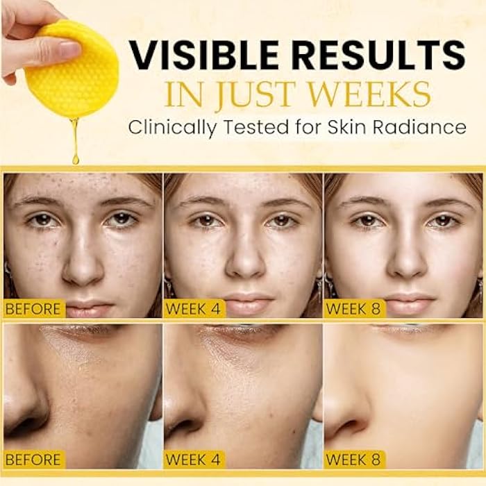 Dermatrue Turmeric Kojic Acid Cleansing Pads For Face Exfoliating And Dark Spots, 80pcs, Brightening, Balance and Moisturize Skin, with Vitamin B, Retinol, Prickly Pear, Olive Oil, Gentle For All Skin Types - Image 2