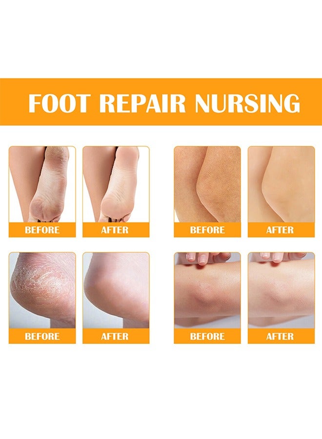 Elaimei Foot Peeling Spray，Foot Peeling Spray For Remove Dead Skin Pedicure Dead Skin Exfoliator For Cracked Rough Heels Dry Toe Skin & Calluses Quicky Remove Dead Skin (Orange) - Image 4