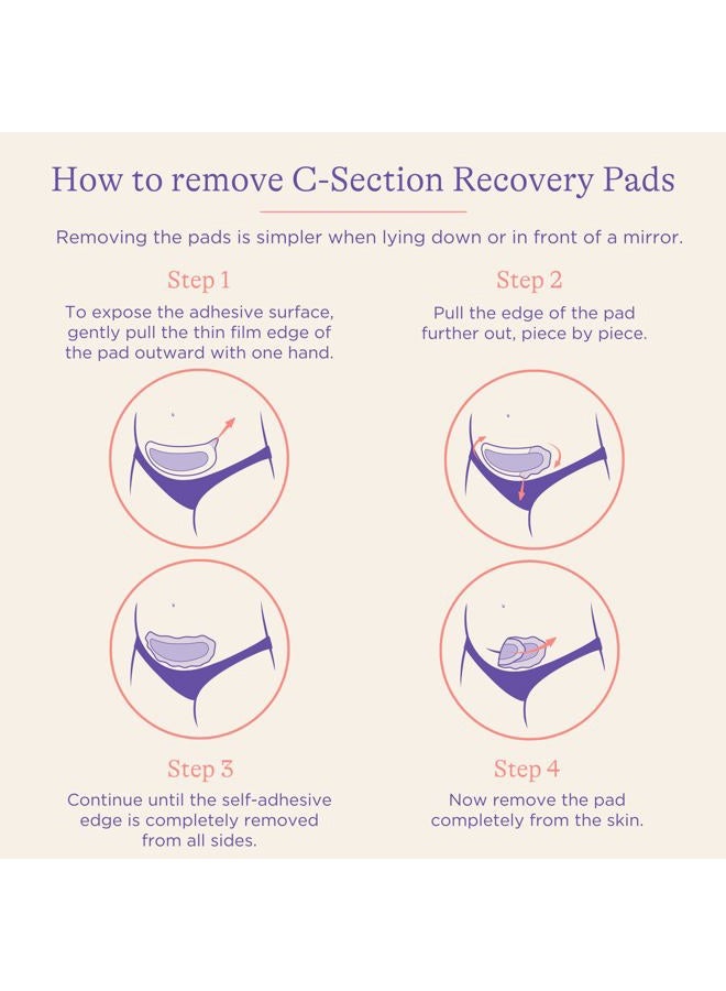 Lansinoh وسادات التعافي من العملية القيصرية، أساسيات ما بعد الولادة القيصرية، 4 وسادات معقمة توفر راحة تبريد لمنطقة الندبة، ضرورية للتعافي من العملية القيصرية، رائعة لسجل المولود - Image 4