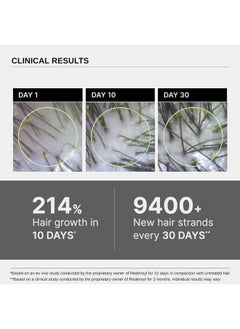 BARE ANATOMY Advanced Hair Growth Serum | 3% Redensyl + 4% Anagain + 3% Baicapil + 1% Capilia Longa, Rosemary, Biotin & Rice Extract | Hair Growth & Hair Fall Control Serum For Women & Men | 30Ml  - Image 4