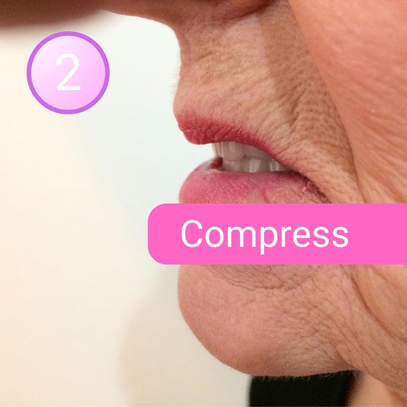 Stabil-Dent Denture Sore Spot Find And Remove Kit - Image 3