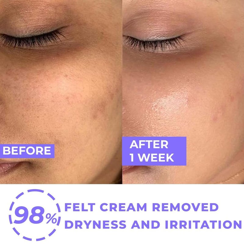 Light Up Beauty Wave Hydrating Day Cream with 5 Squalane 2 Niacinamide for Healthy Hydrated Skin Reduce Pores Dark Spots 72 Hours Hydration Repair Damaged Skin 50g - Image 3