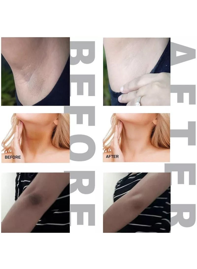 Dark Spot Cream - Natural Underarm and Intimate Cream - Dark Spot Corrector - for Face and Sensitive Skin- for Hyperpigmentation and Even Skin Tone - Alpha Arbutin, Niacinamide(1.7OZ/50ML)