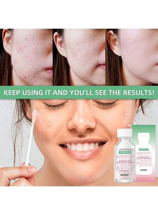 باروبت حمض الساليسيليك لوشن تجفيف حب الشباب 40ml-إصلاح حب الشباب ، يعزز إزالة حب الشباب ، لجميع أنواع الجلد - Image 2